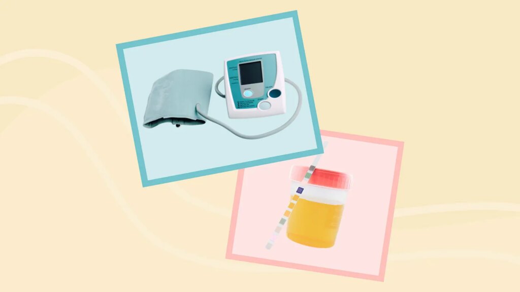 How to Monitor Proteinuria and Blood Pressure at Home With FSGS