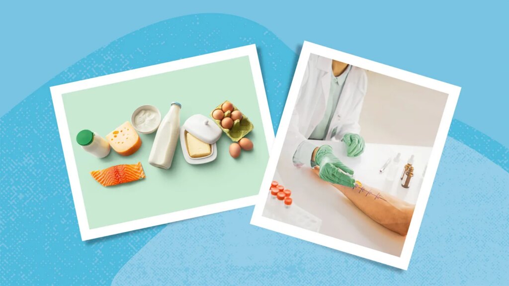 Eczema Elimination Diet: Should You Try It?
