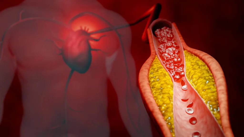 Millions may be getting the wrong cholesterol test