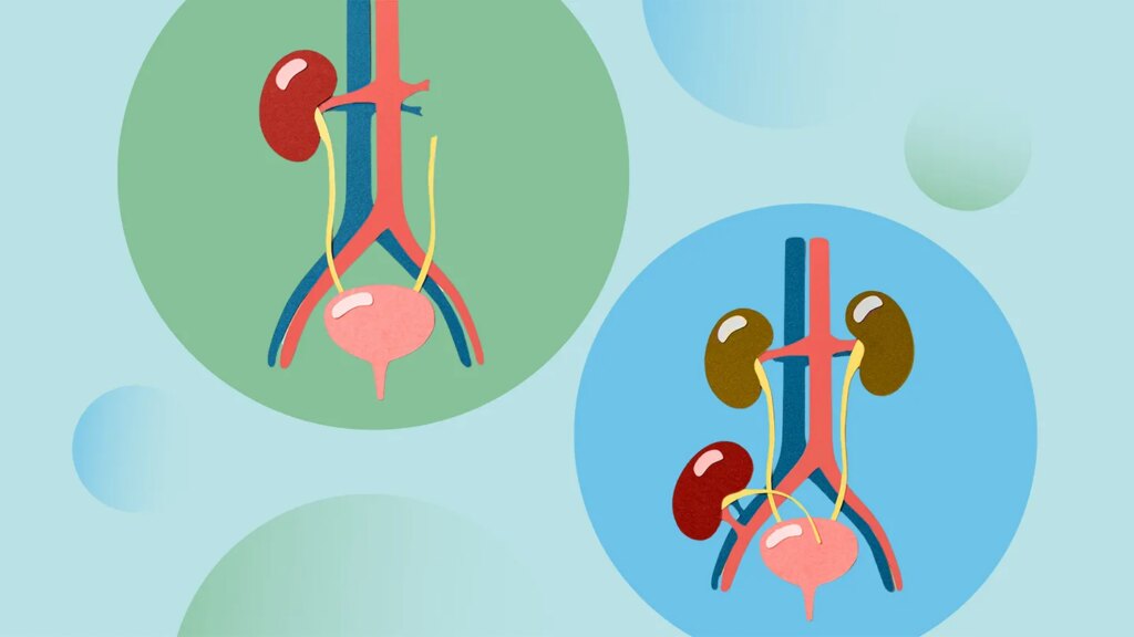 Kidney Transplant Benefits and Risks for IgA Nephropathy
