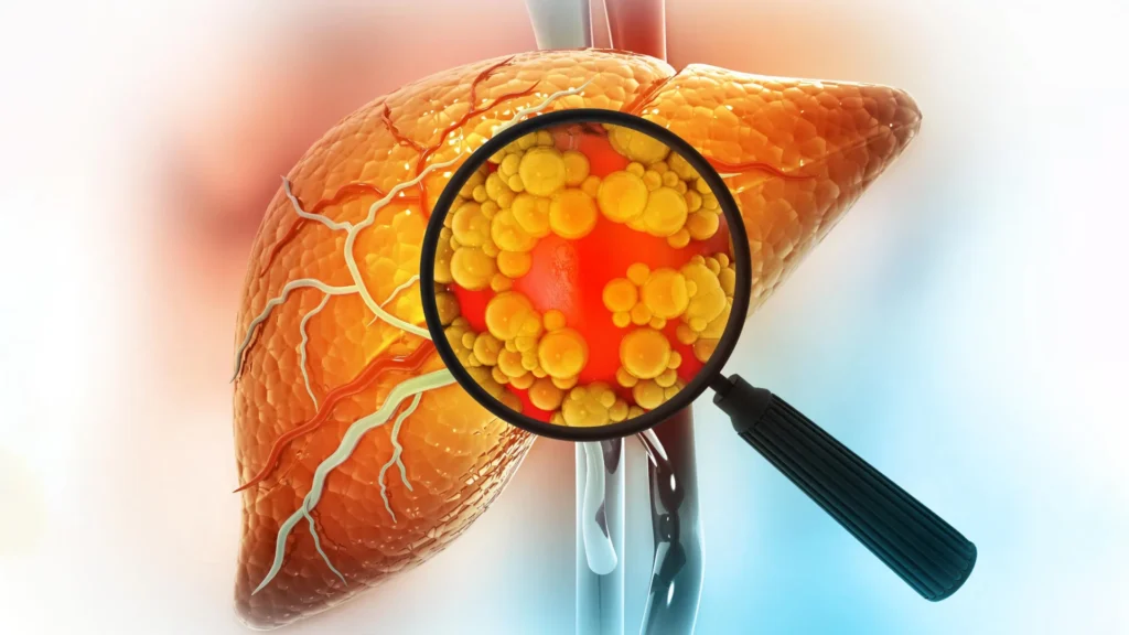 Experimental drug reverses severe fatty liver disease by repairing the gut